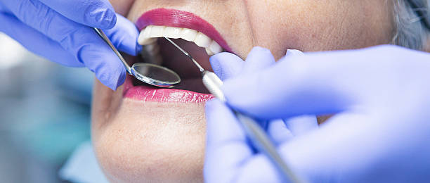 Best Dental Abscess Treatment in North Beach, MD